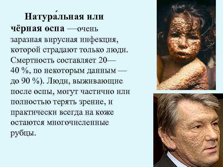 Натура льная или чёрная оспа —очень заразная вирусная инфекция, которой страдают только люди. Смертность