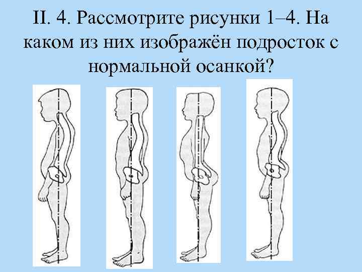 Рассмотрите рисунки 1 4