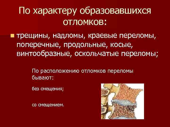 По характеру образовавшихся отломков: n трещины, надломы, краевые переломы, поперечные, продольные, косые, винтообразные, оскольчатые