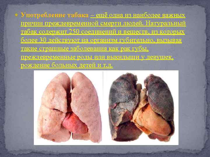  Употребление табака – ещё одна из наиболее важных причин преждевременной смерти людей. Натуральный