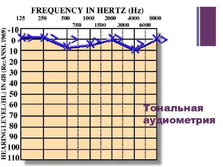 + Тональная аудиометрия 