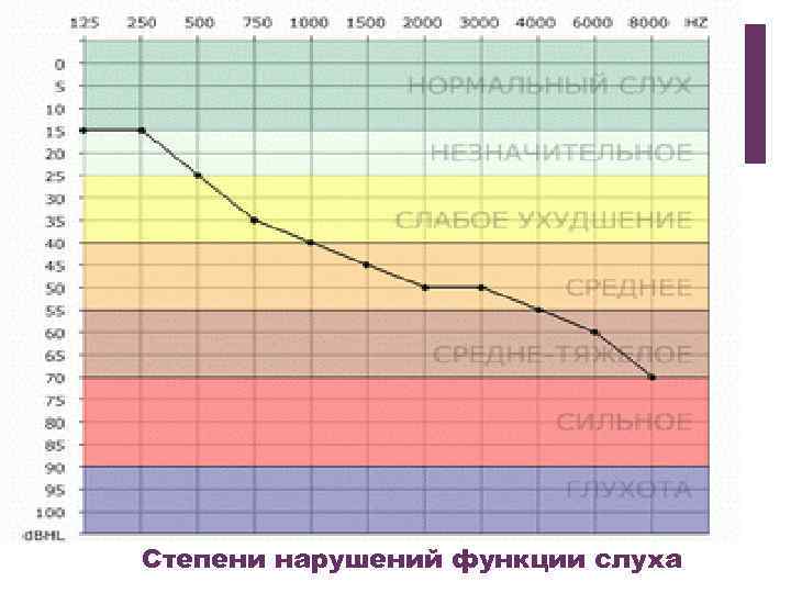 + Степени нарушений функции слуха 