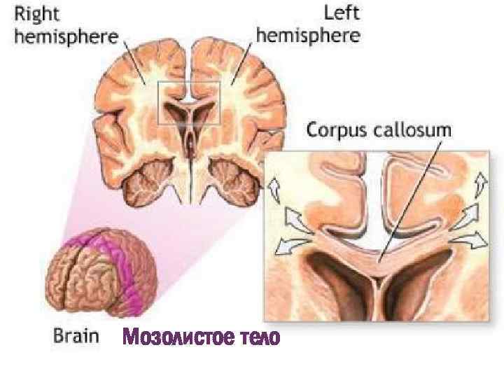 + Мозолистое тело 