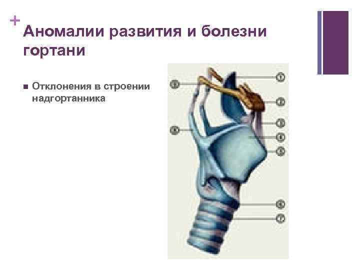 + Аномалии развития и болезни гортани n Отклонения в строении надгортанника 