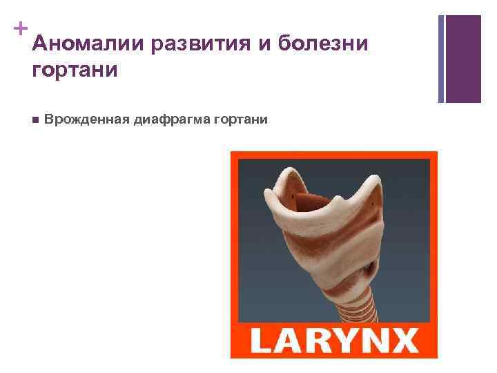 + Аномалии развития и болезни гортани n Врожденная диафрагма гортани 