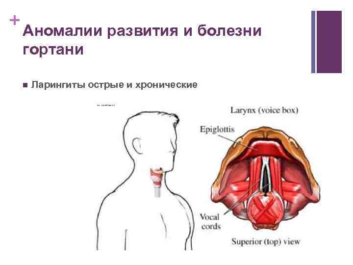 Гортань Болезни Симптомы Фото