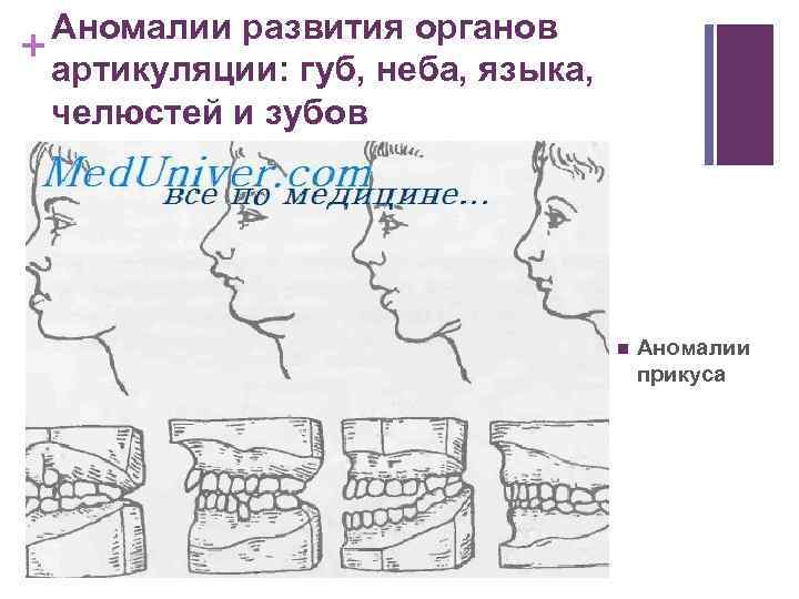 Нижняя губа на верхние зубы. Дистальный прикус и глубокий прикус. Дистальный прикус челюсти. Прикус норма и патология. Мезиальный, глубокий, дистальный прикус.