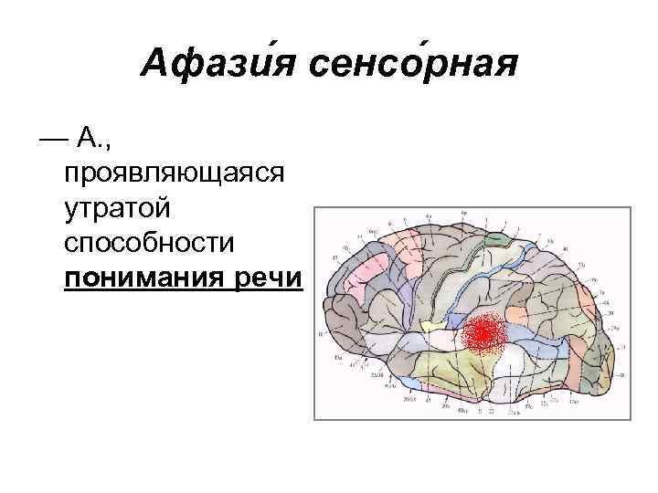 Афази я сенсо рная — А. , проявляющаяся утратой способности понимания речи 