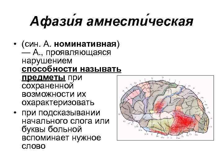Афази я амнести ческая • (син. А. номинативная) — А. , проявляющаяся нарушением способности