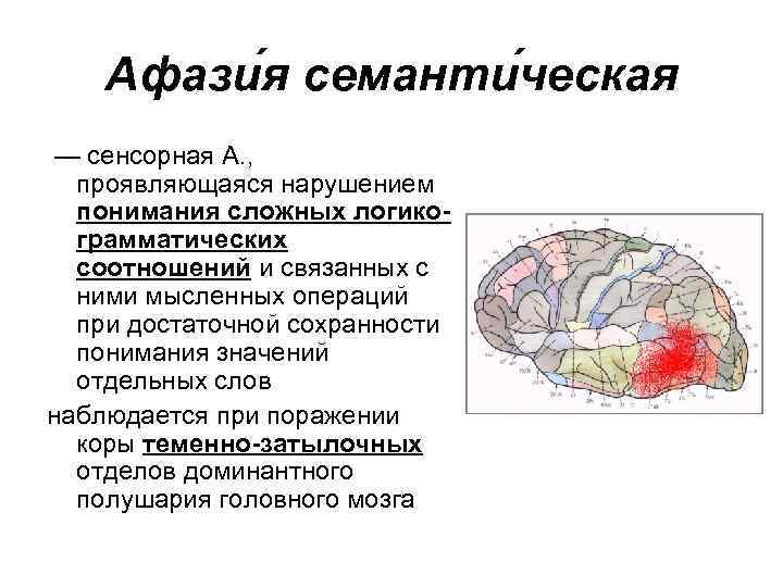 Афази я семанти ческая — сенсорная А. , проявляющаяся нарушением понимания сложных логикограмматических соотношений