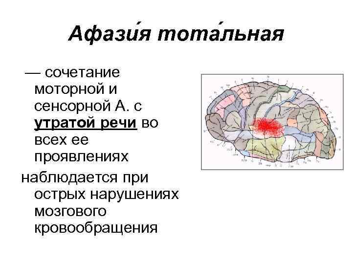 Афази я тота льная — сочетание моторной и сенсорной А. с утратой речи во