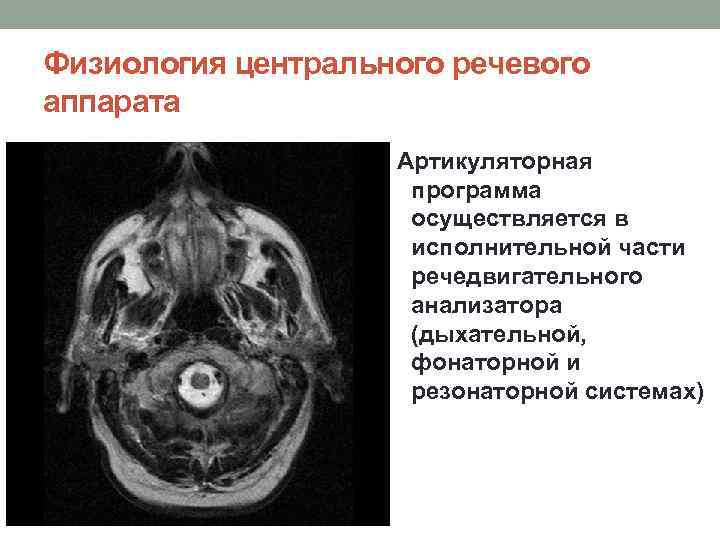 Физиология центрального речевого аппарата Артикуляторная программа осуществляется в исполнительной части речедвигательного анализатора (дыхательной, фонаторной