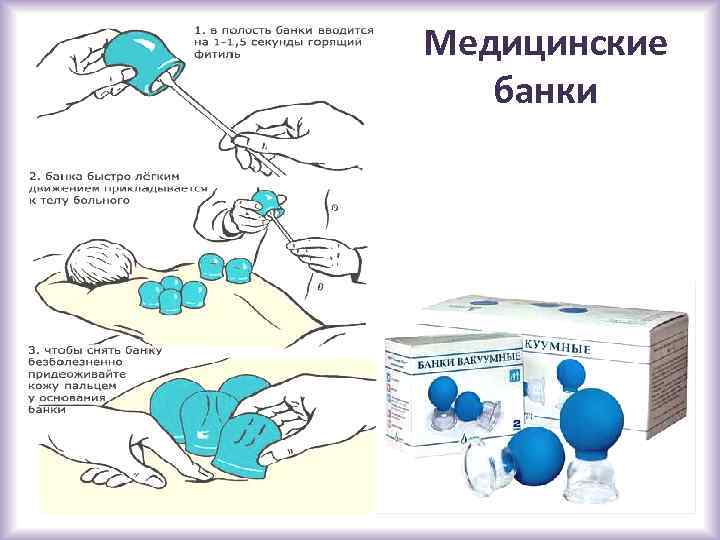 Медицинские банки 