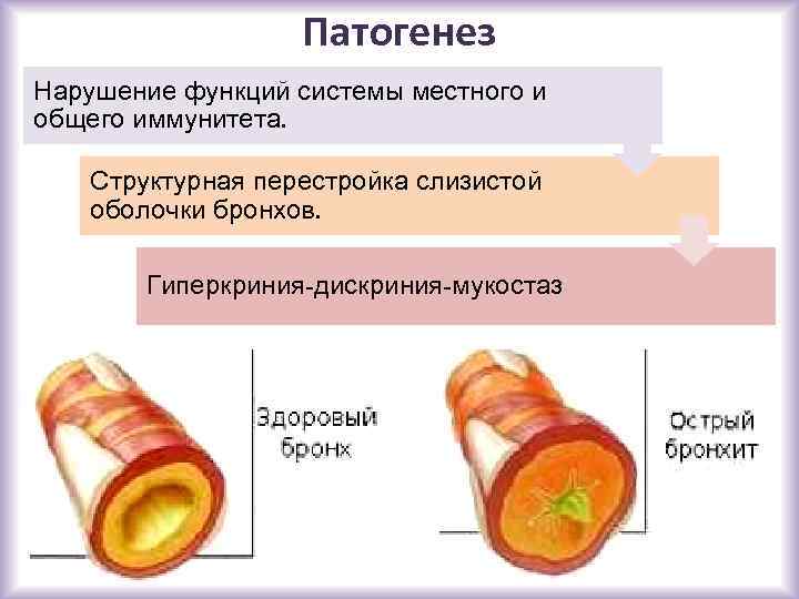 Патогенез Нарушение функций системы местного и общего иммунитета. Структурная перестройка слизистой оболочки бронхов. Гиперкриния-дискриния-мукостаз