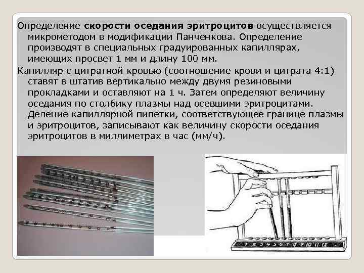 Определение скорости оседания эритроцитов осуществляется микрометодом в модификации Панченкова. Определение производят в специальных градуированных