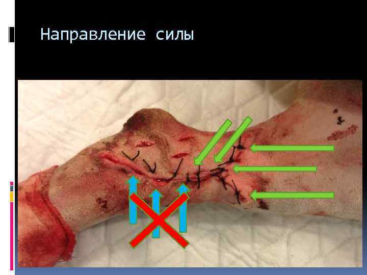 Направление силы 