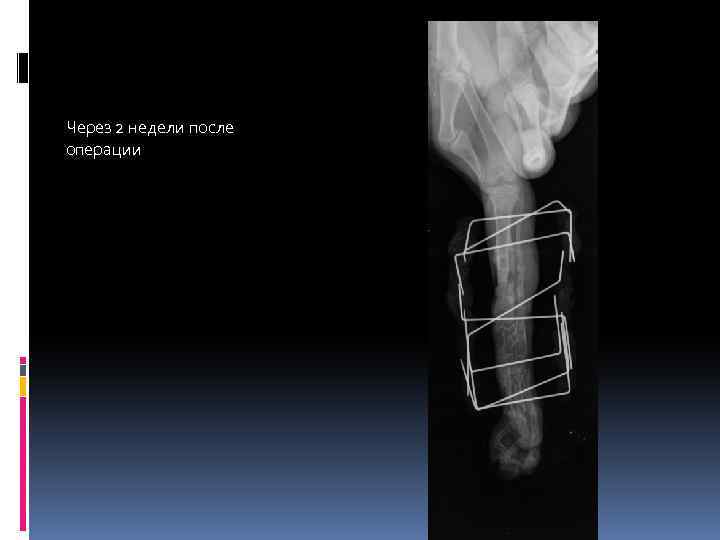 Через 2 недели после операции 