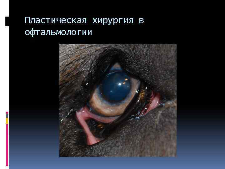Пластическая хирургия в офтальмологии 