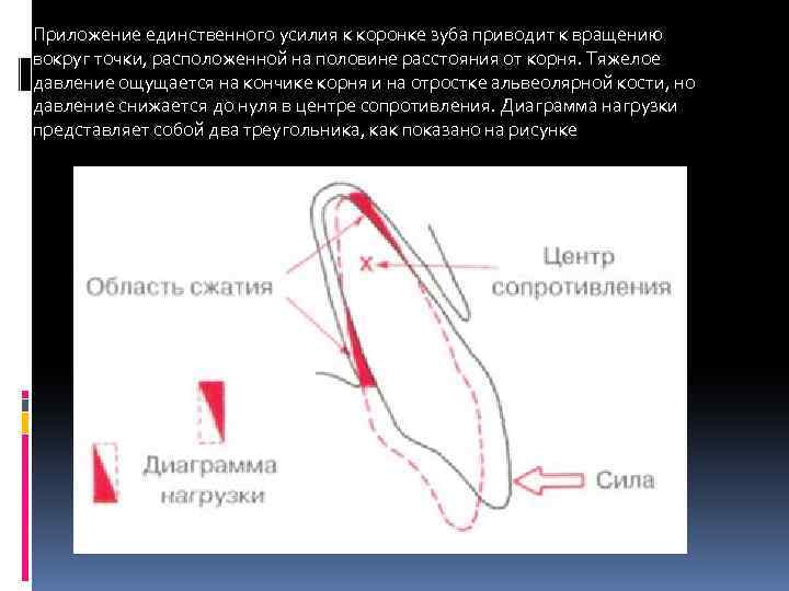 Приложение единственного усилия к коронке зуба приводит к вращению вокруг точки, расположенной на половине