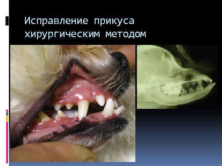 Исправление прикуса хирургическим методом 