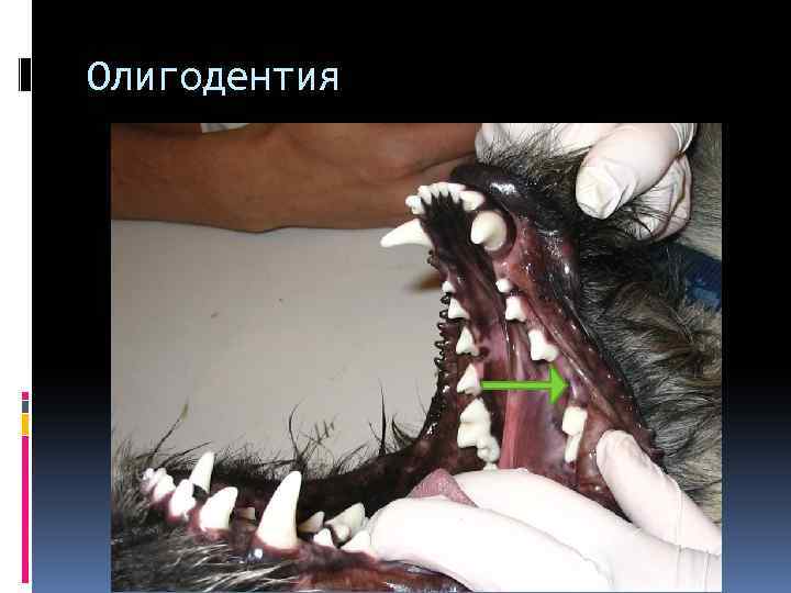 Олигодентия 