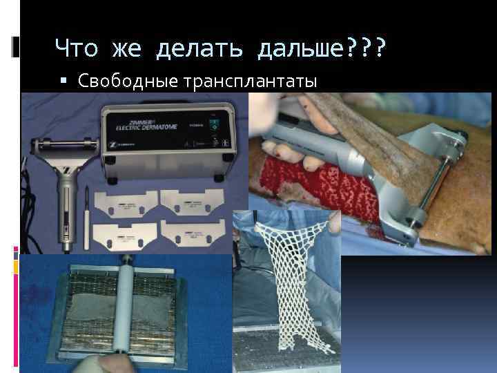 Что же делать дальше? ? ? Свободные трансплантаты 