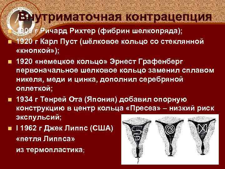 Внутриматочная контрацепция 1909 г Ричард Рихтер (фибрин шелкопряда); n 1920 г Карл Пуст (шёлковое