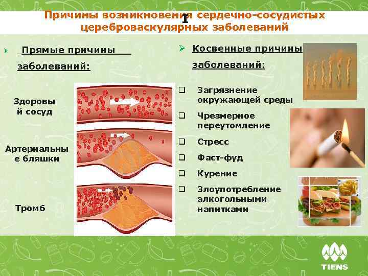 Причины возникновения сердечно-сосудистых цереброваскулярных заболеваний I Ø Прямые причины Ø Косвенные причины заболеваний: q