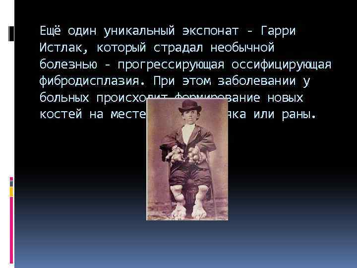 Ещё один уникальный экспонат - Гарри Истлак, который страдал необычной болезнью - прогрессирующая оссифицирующая