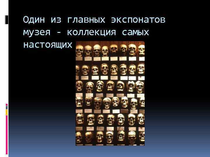 Один из главных экспонатов музея - коллекция самых настоящих черепов. 