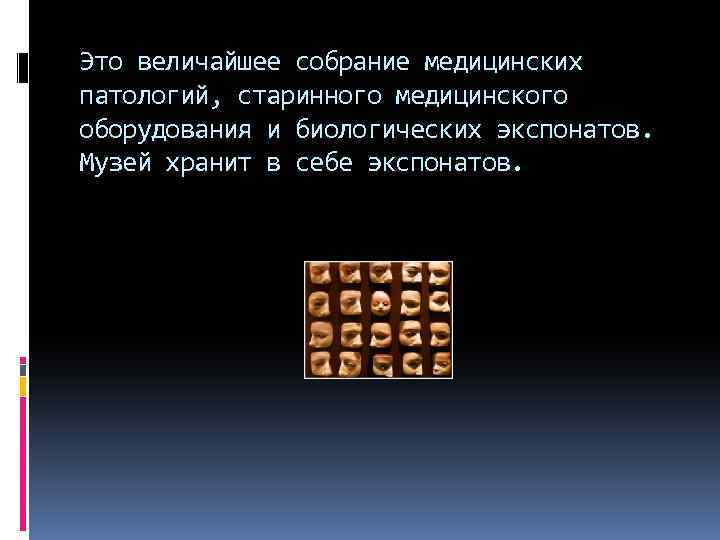 Это величайшее собрание медицинских патологий, старинного медицинского оборудования и биологических экспонатов. Музей хранит в