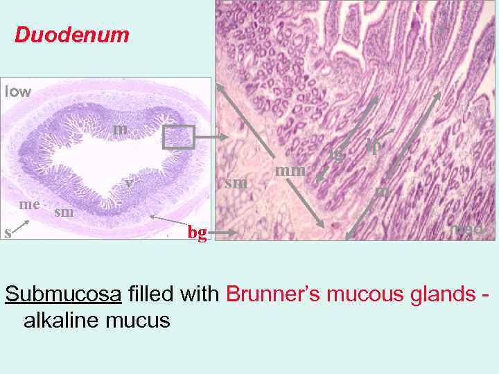 v Duodenum low m v sm v me sm s bg mm ig lp