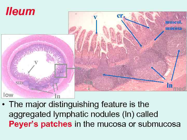 Ileum v cr. muscul. mucosa v sm sm low ln lnmed • The major