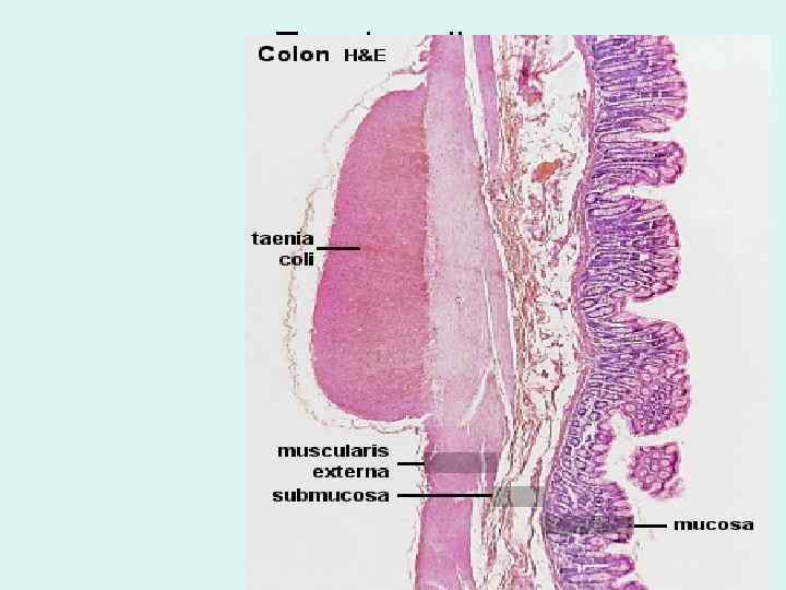 Taenia coli 