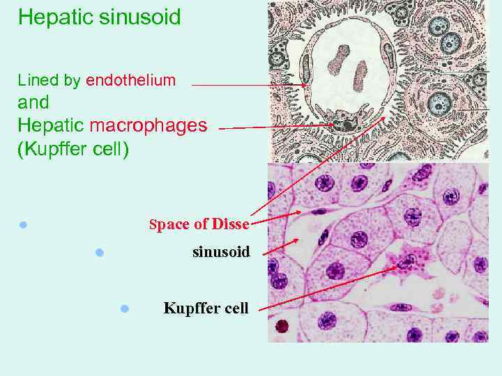 Hepatic sinusoid Lined by endothelium and Hepatic macrophages (Kupffer cell) Space of Disse l