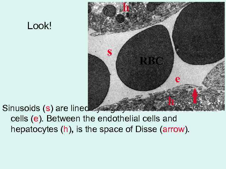 h Look! s RBC e h endothelial Sinusoids (s) are lined by highly fenestrated