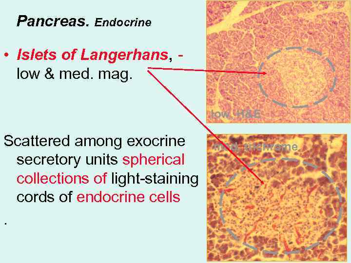 Pancreas. Endocrine • Islets of Langerhans, low & med. mag. low, H&E Scattered among