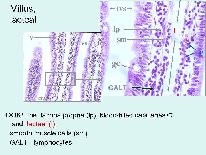 Villus, lacteal v ivs lp sm l gc GALT low LOOK! The lamina propria