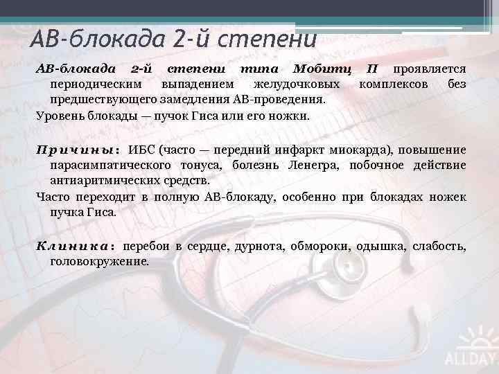 АВ-блокада 2 -й степени типа Мобитц II проявляется периодическим выпадением желудочковых комплексов без предшествующего