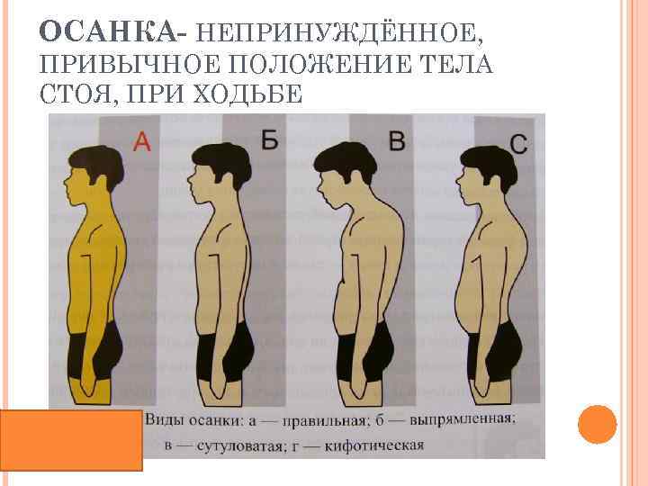 ОСАНКА- НЕПРИНУЖДЁННОЕ, ПРИВЫЧНОЕ ПОЛОЖЕНИЕ ТЕЛА СТОЯ, ПРИ ХОДЬБЕ 