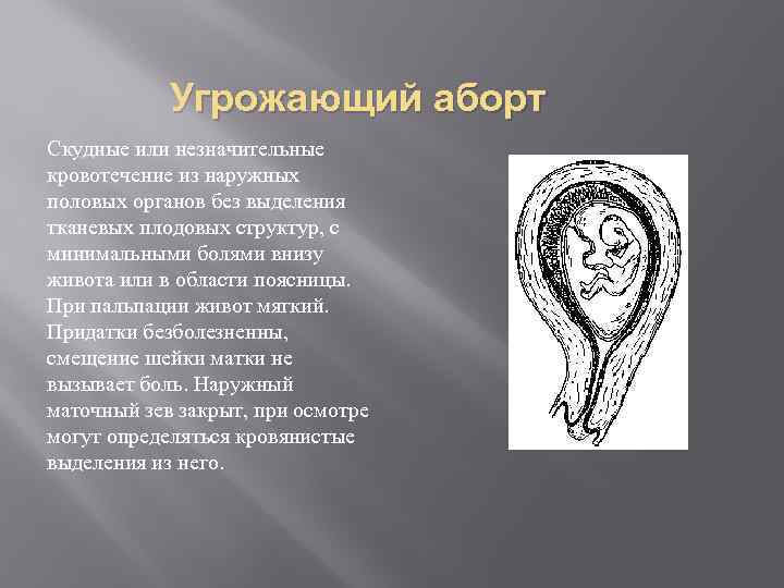 Угрожающий аборт Скудные или незначительные кровотечение из наружных половых органов без выделения тканевых плодовых