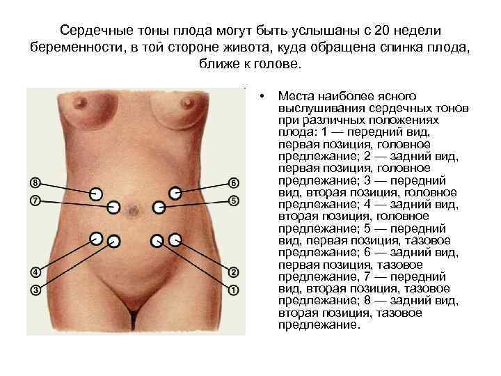 Сердечные тоны плода могут быть услышаны с 20 недели беременности, в той стороне живота,