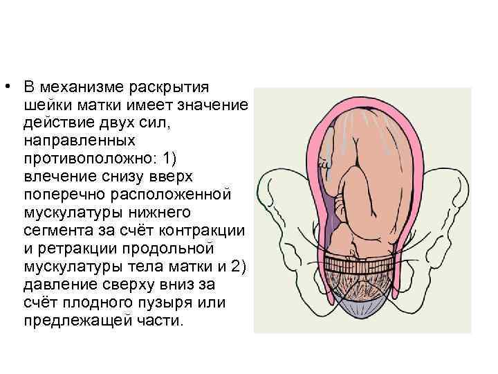  • В механизме раскрытия шейки матки имеет значение действие двух сил, направленных противоположно: