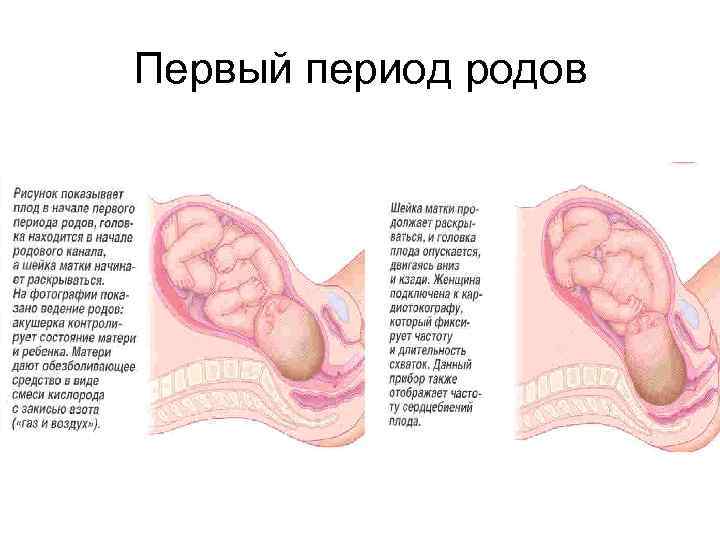 Первым периодом родов. Первый период родов. Период раскрытия в родах. Первый период родов раскрытие. Первый период родов плод.