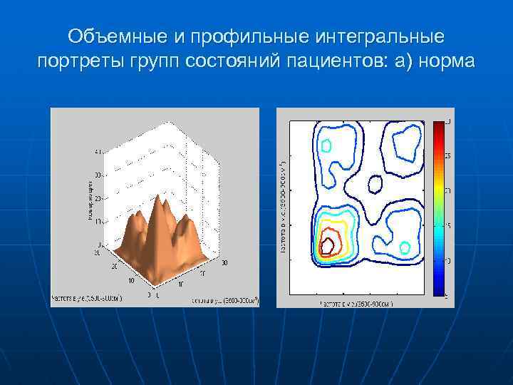 Объемные и профильные интегральные портреты групп состояний пациентов: а) норма 