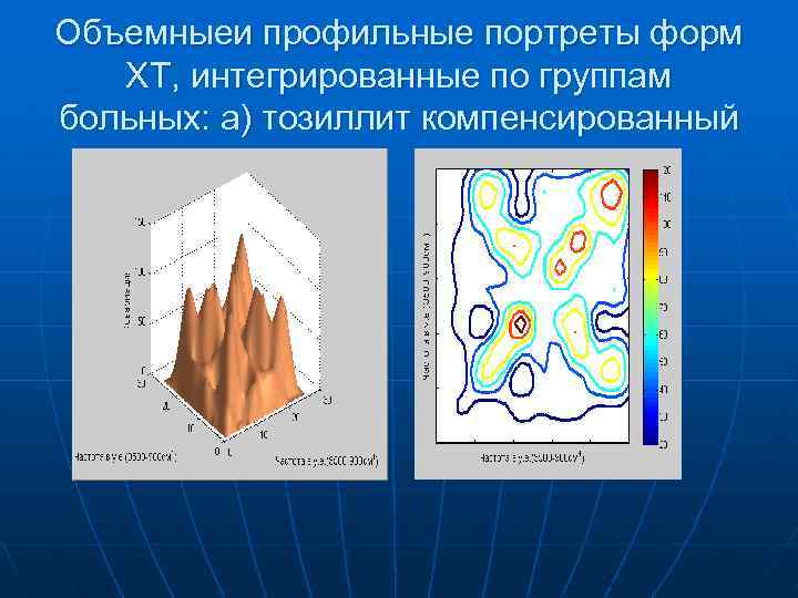 Объемныеи профильные портреты форм ХТ, интегрированные по группам больных: а) тозиллит компенсированный 