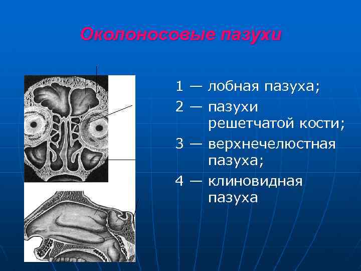 Околоносовые пазухи 1 — лобная пазуха; 2 — пазухи решетчатой кости; 3 — верхнечелюстная