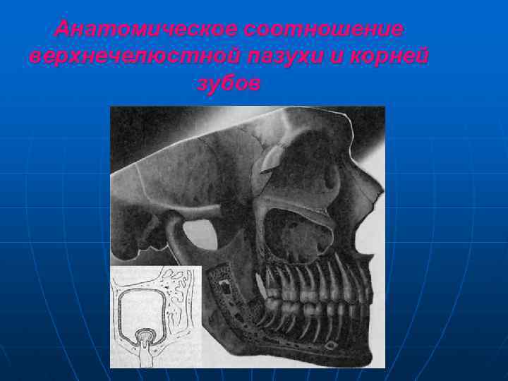 Анатомическое соотношение верхнечелюстной пазухи и корней зубов 