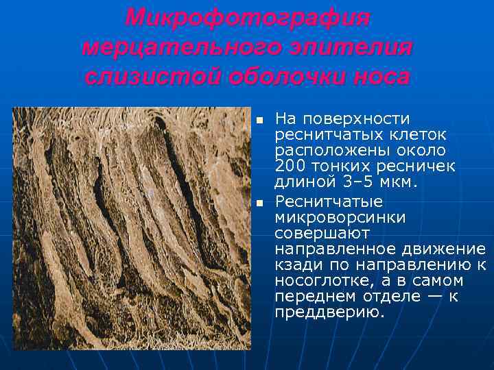 Микрофотография мерцательного эпителия слизистой оболочки носа n n На поверхности реснитчатых клеток расположены около