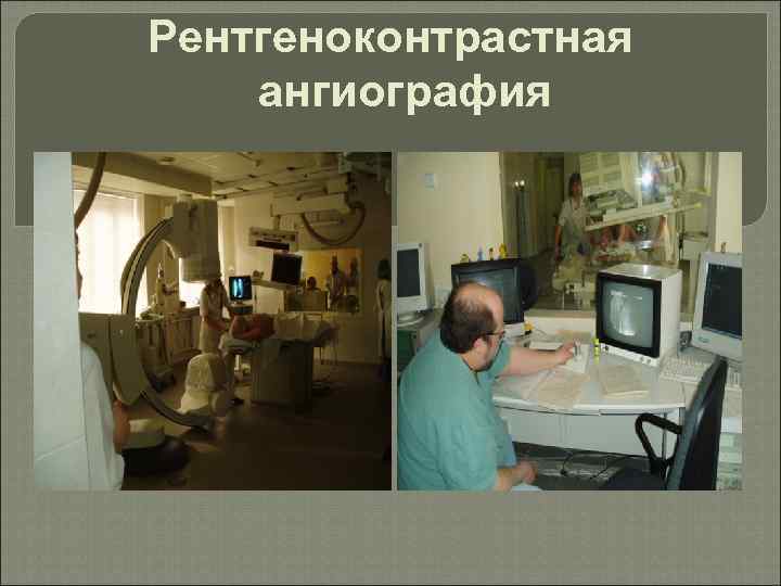 Рентгеноконтрастная ангиография 